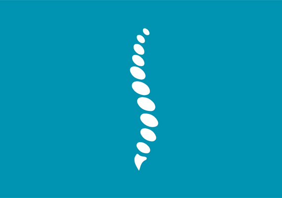 scoliosi